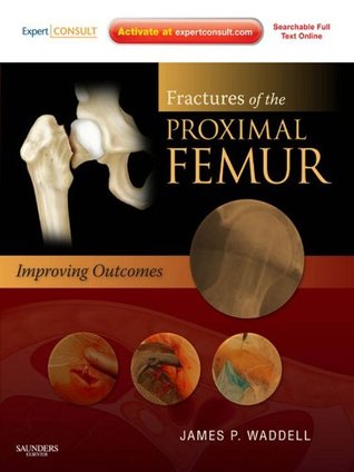 Read online Fractures of the Proximal Femur: Improving Outcomes - James P. Waddell file in ePub