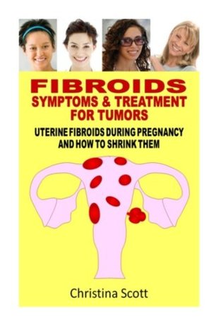 Download Fibroids : Symptoms & Treatment For Tumors: Uterine Fibroids During Pregnancy How To Shrink Them - Christina Scott file in ePub